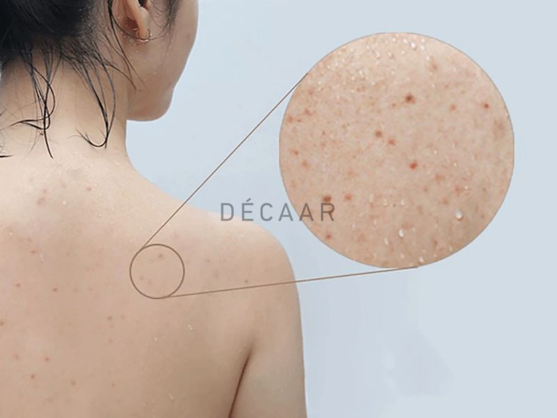 Thay đổi hormone